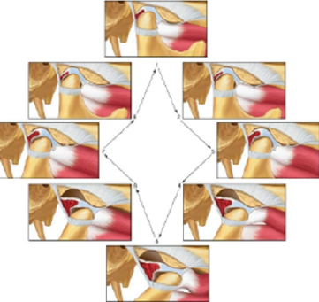 SAODS-07-0390-figure